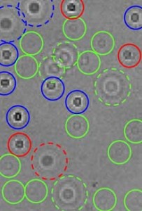 Software Identifying Blood Cell Shadows